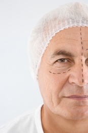 Photo of Senior man with marks on face preparing for cosmetic surgery against white background, closeup