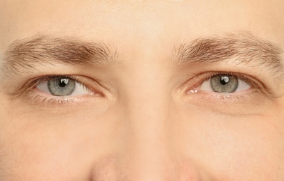 Photo of Young man, closeup of eyes. Visiting ophthalmologist