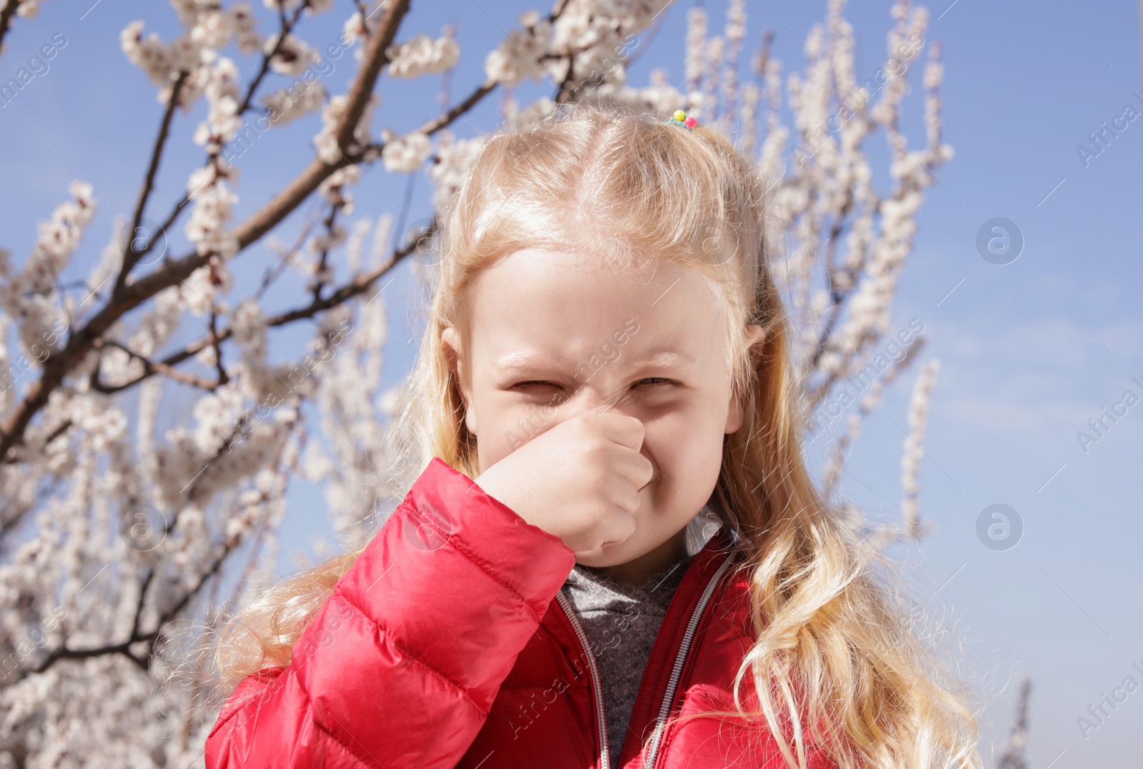 Photo of Little girl suffering from seasonal allergy outdoors