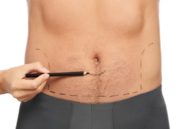 Photo of Doctor with pencil preparing patient for cosmetic surgery operation on white background, closeup