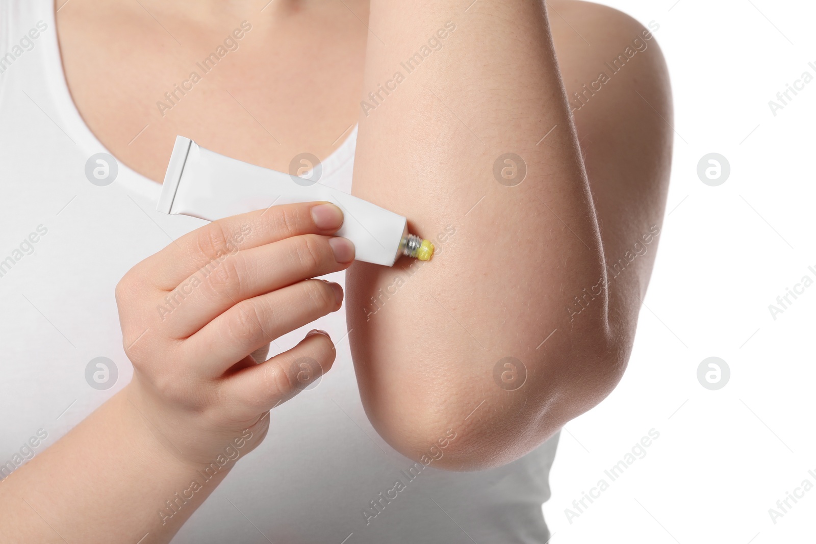 Photo of Woman applying ointment from tube onto her elbow on white background, closeup