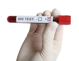 Scientist holding tube with blood sample and label HIV Test on white background, closeup