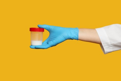 Scientist holding container with sperm on yellow background, closeup