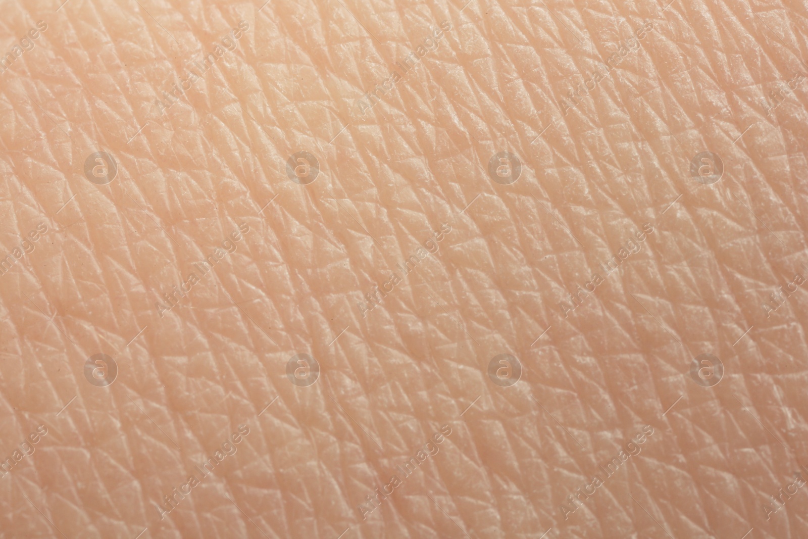 Photo of Texture of dry skin as background, macro view