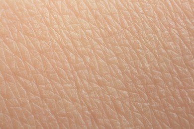 Texture of dry skin as background, macro view