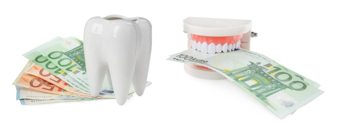 Image of Collage with educational dental models and money on white background, banner design. Expensive teeth treatment