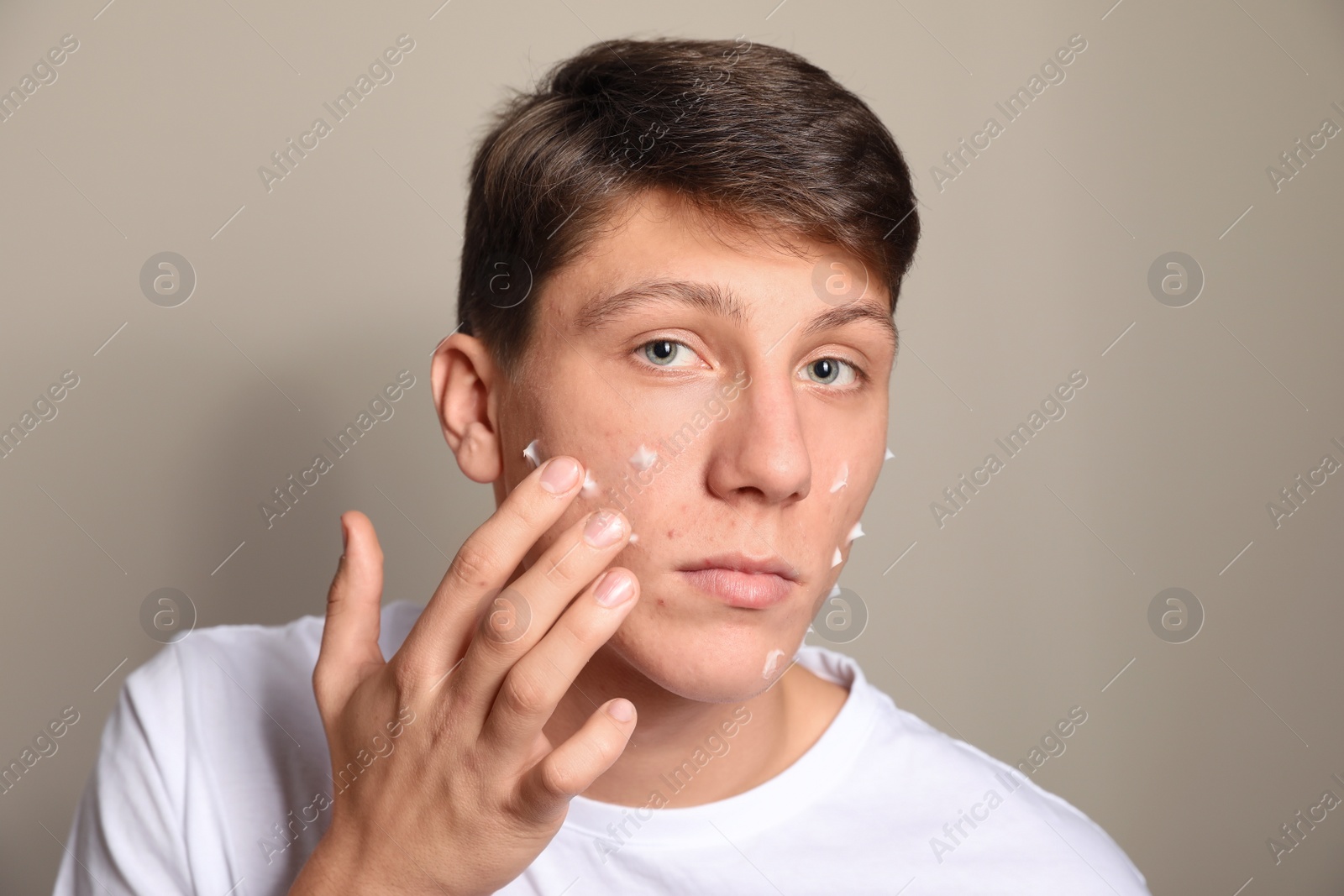 Photo of Teen guy with acne problem applying cream on beige background