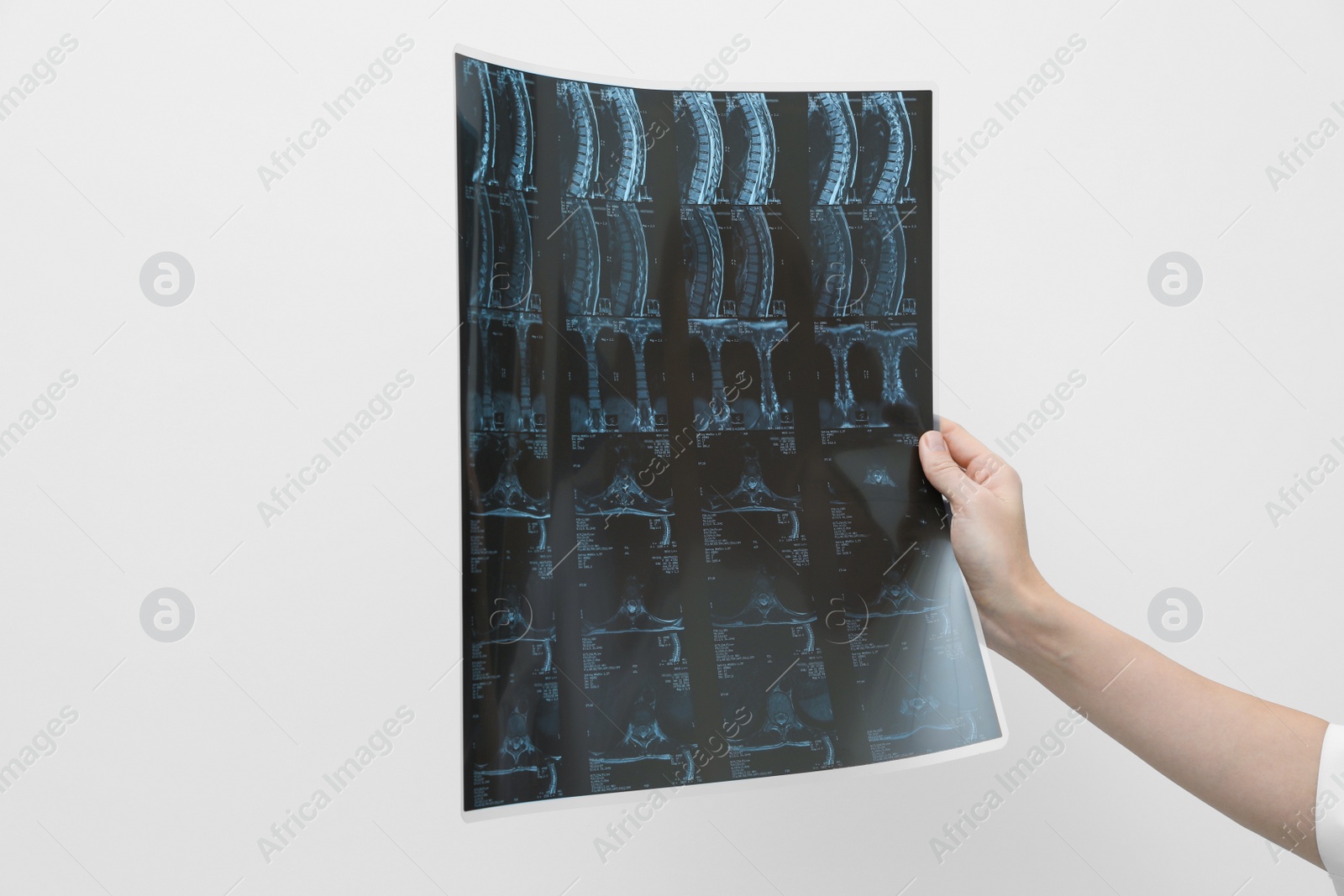 Photo of Doctor examining neck MRI image on light grey background, closeup