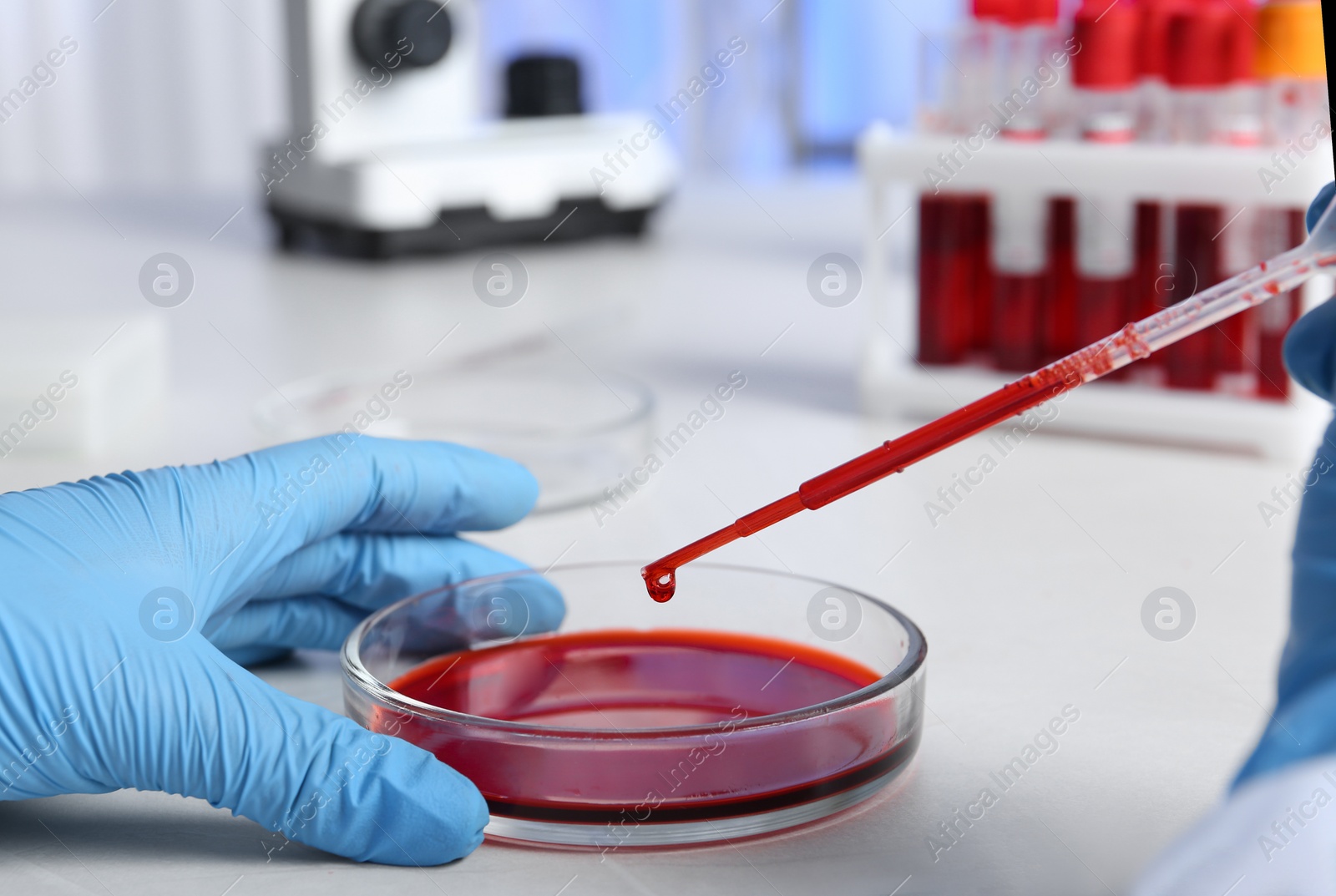 Photo of Laboratory worker pipetting blood sample into Petri dish for analysis on table, closeup