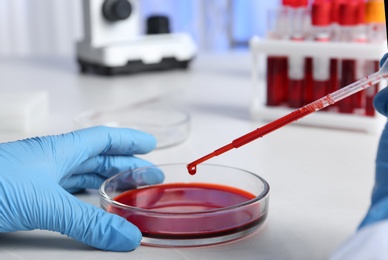 Laboratory worker pipetting blood sample into Petri dish for analysis on table, closeup