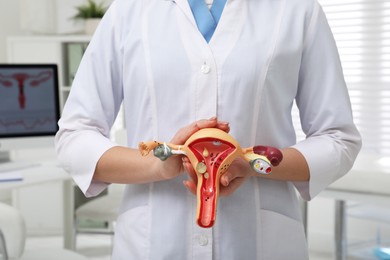 Photo of Gynecologist demonstrating model of female reproductive system in clinic, closeup