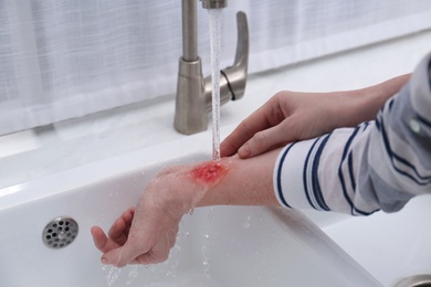 Photo of Woman holding forearm with burn under flowing water indoors, closeup
