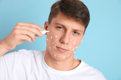 Photo of Teen guy with acne problem applying cream on light blue background