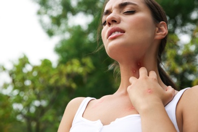 Photo of Woman scratching neck with insect bite in park