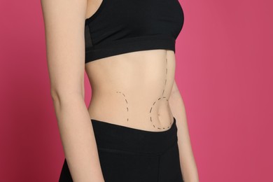 Photo of Slim woman with marks on body against pink background, closeup. Weight loss surgery