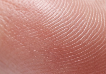 Photo of Closeup view of human finger. Friction ridge pattern