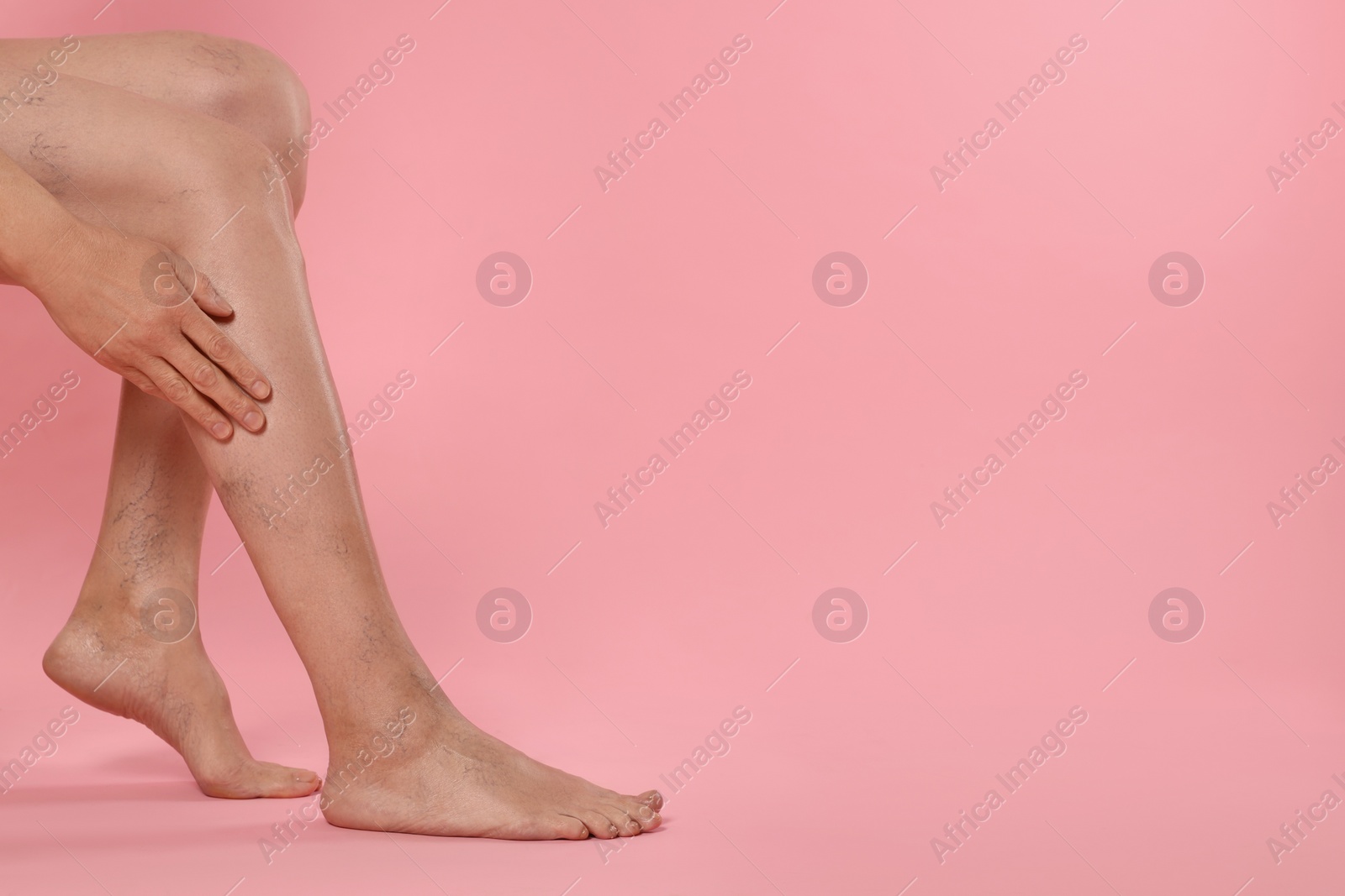 Photo of Closeup view of woman suffering from varicose veins on pink background. Space for text