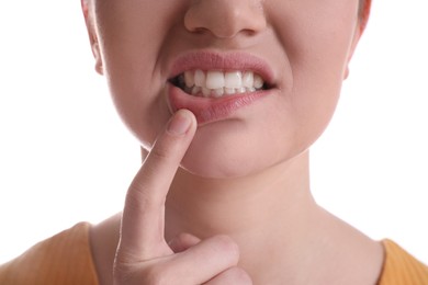Photo of Woman showing gums on white background, closeup view