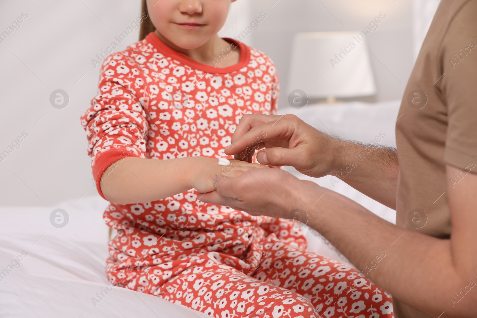 Photo of Father applying ointment onto his daughter's hand on bed, closeup