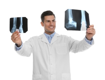 Photo of Orthopedist holding X-ray pictures on white background