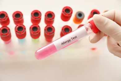 Photo of Doctor holding tube with label ALLERGY TEST over table, closeup