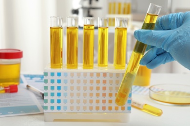 Photo of Doctor holding test tube with urine sample for analysis in laboratory, closeup
