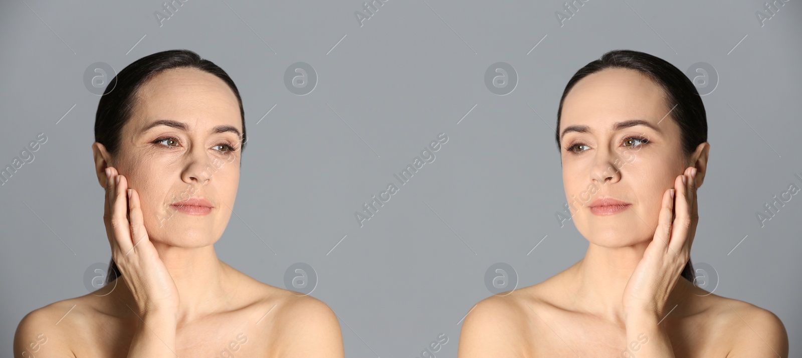 Image of Mature woman before and after cosmetic procedure on grey background, banner design 
