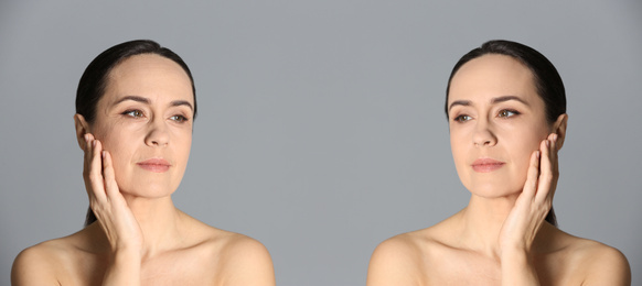 Mature woman before and after cosmetic procedure on grey background, banner design 