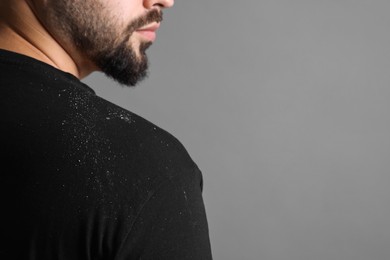 Photo of Man with dandruff on his sweater against grey background, closeup. Space for text