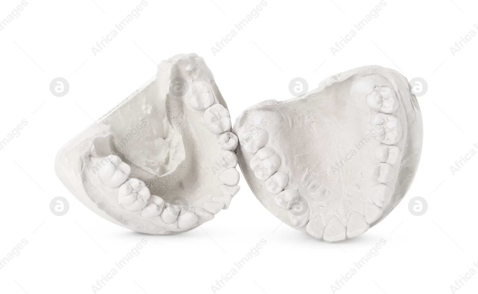 Photo of Dental model with jaws isolated on white. Cast of teeth