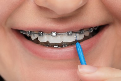Photo of Woman with dental braces cleaning teeth using interdental brush, closeup