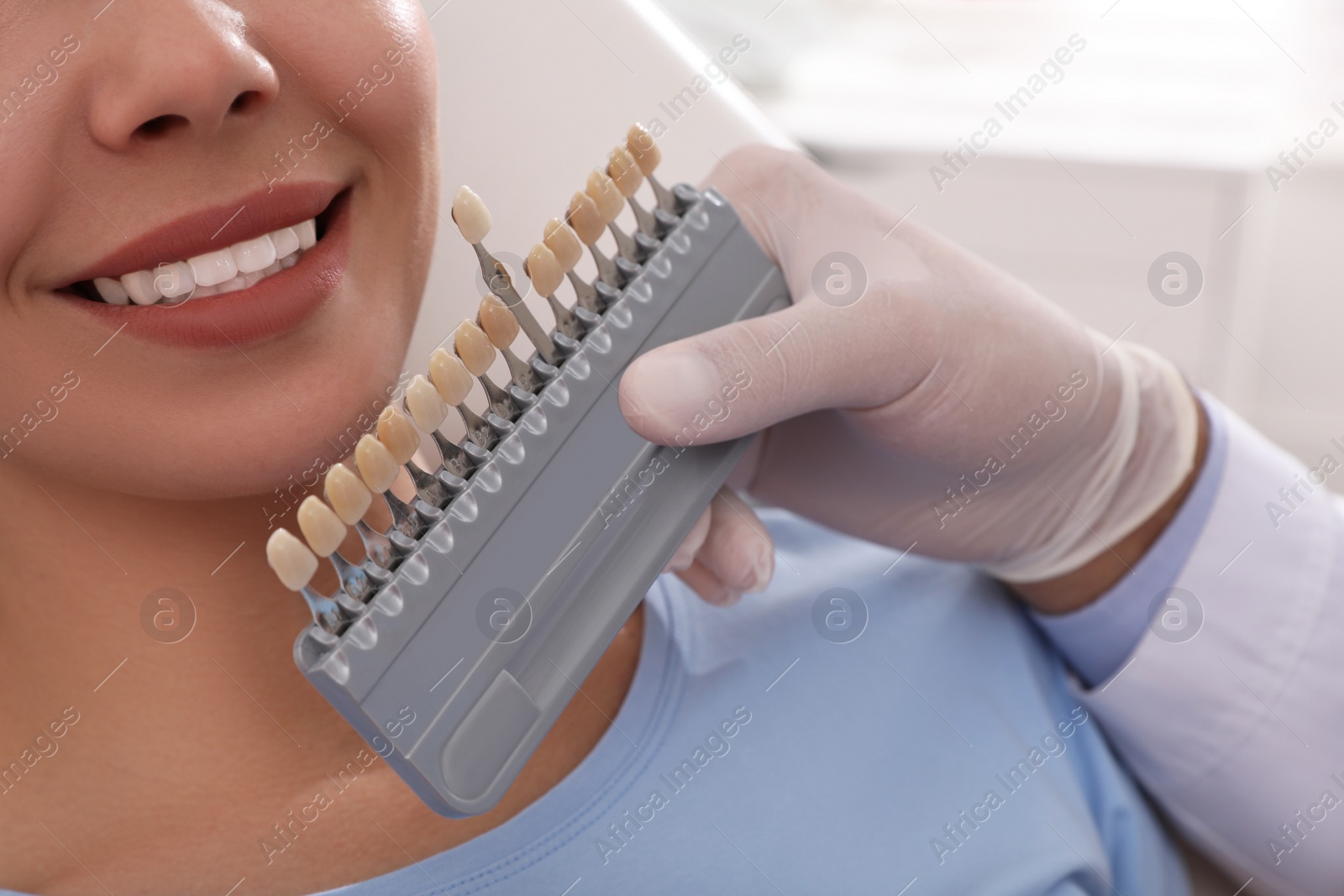 Photo of Dentist checking young woman's teeth color in clinic, closeup