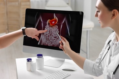 Photo of Gastroenterologist showing screen with illustration of digestive tract to patient at table in clinic, closeup