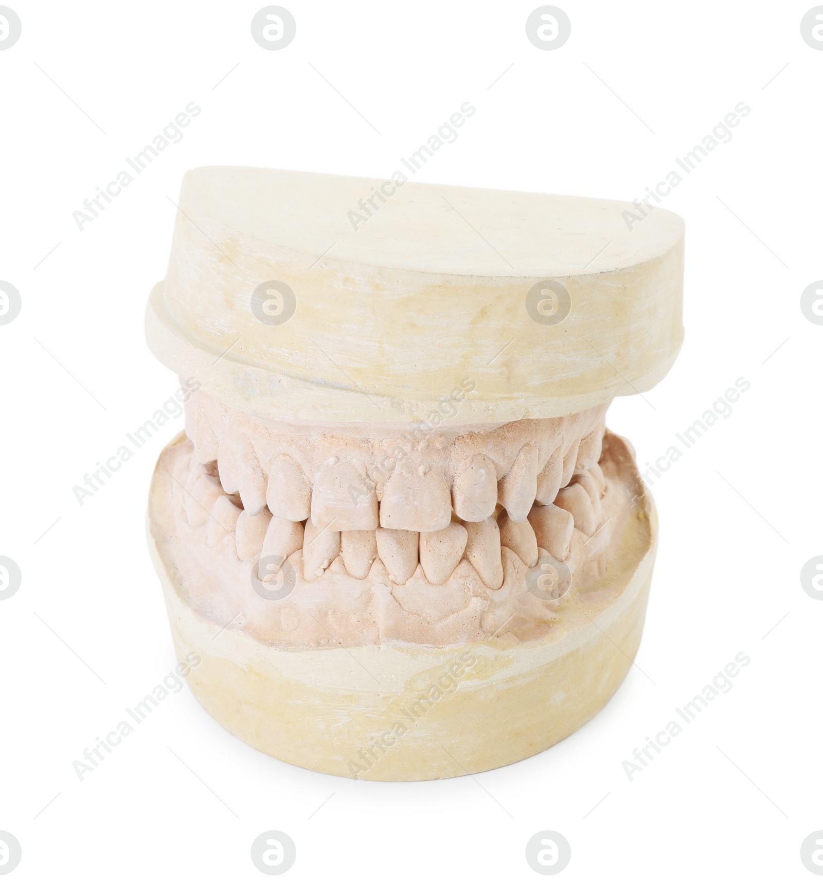 Photo of Dental model with jaws isolated on white. Cast of teeth