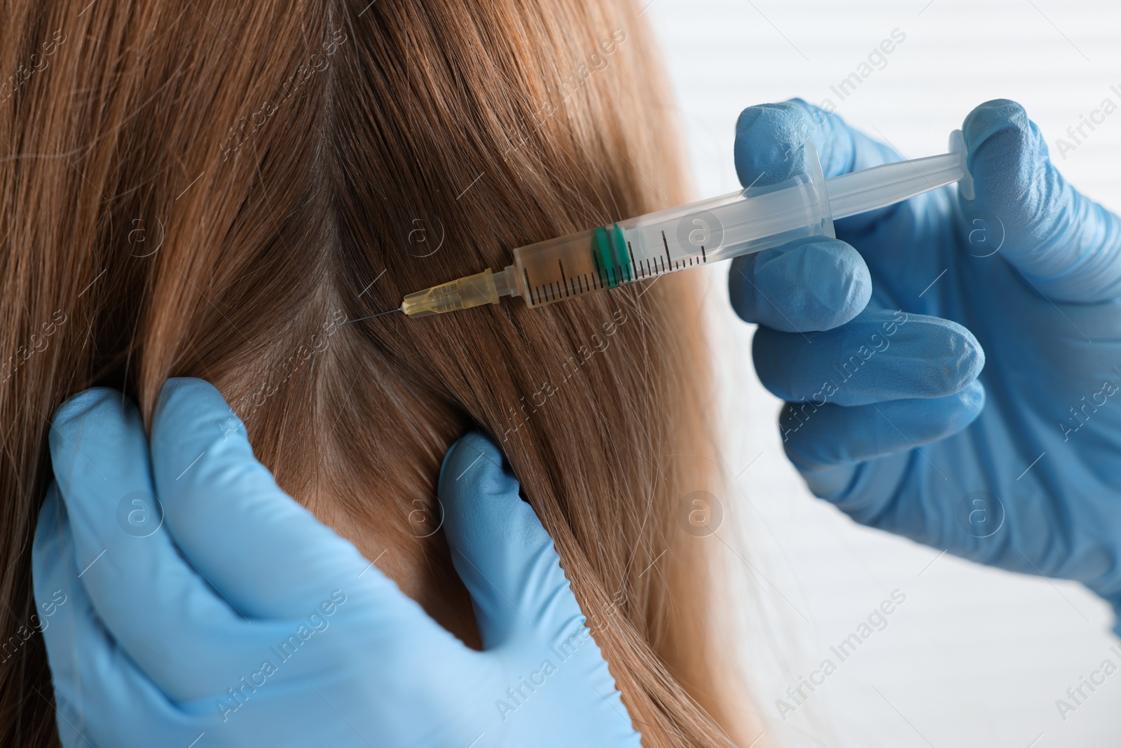 Photo of Trichologist giving injection to patient in clinic, closeup