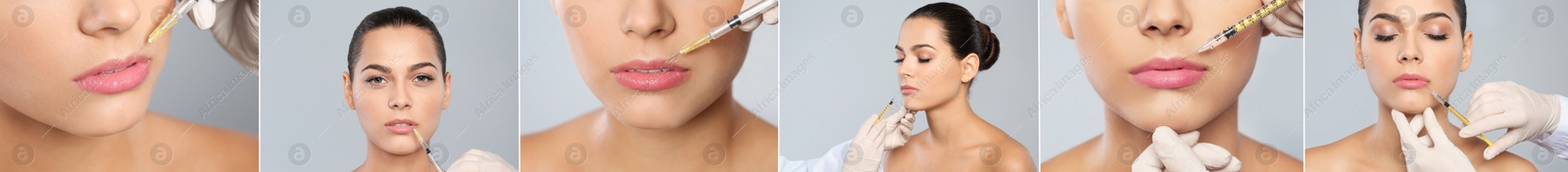 Image of Collage with photos of woman during lip augmentation procedure. Banner design