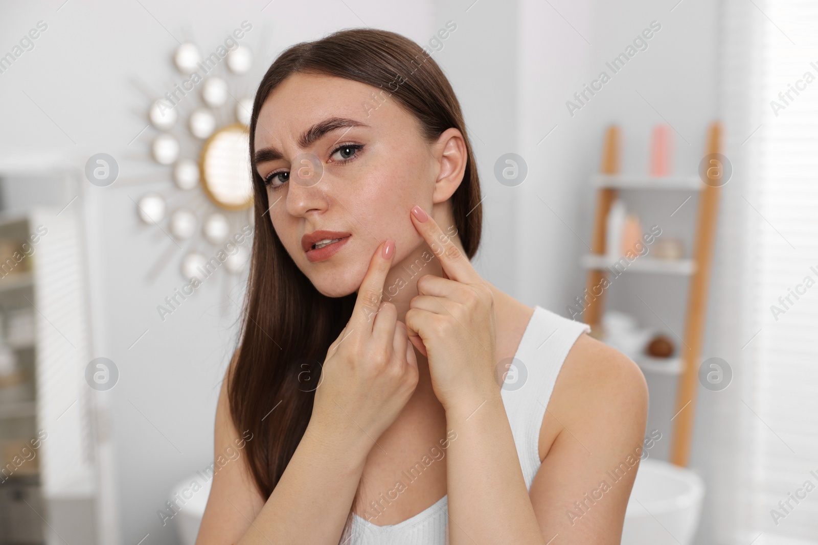 Photo of Young woman with skin problem at home