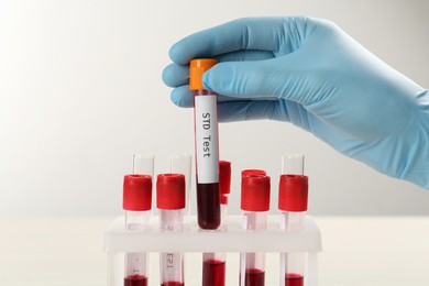 Photo of Scientist taking tube with blood sample and label STD Test from rack at white table, closeup