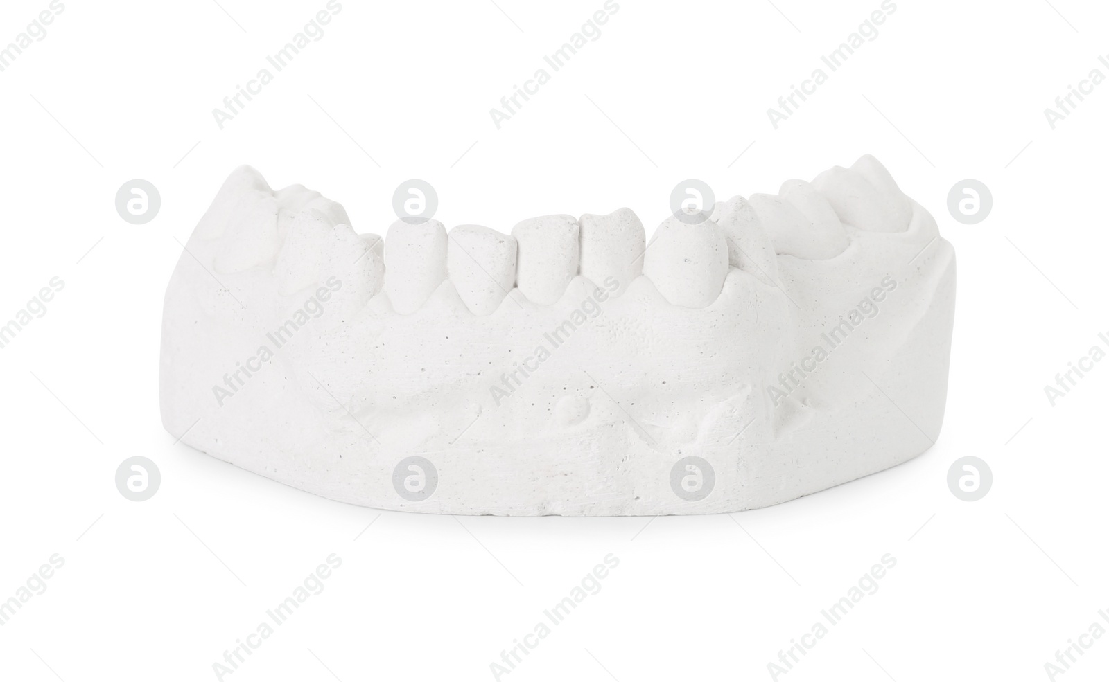 Photo of Dental model with gum isolated on white. Cast of teeth