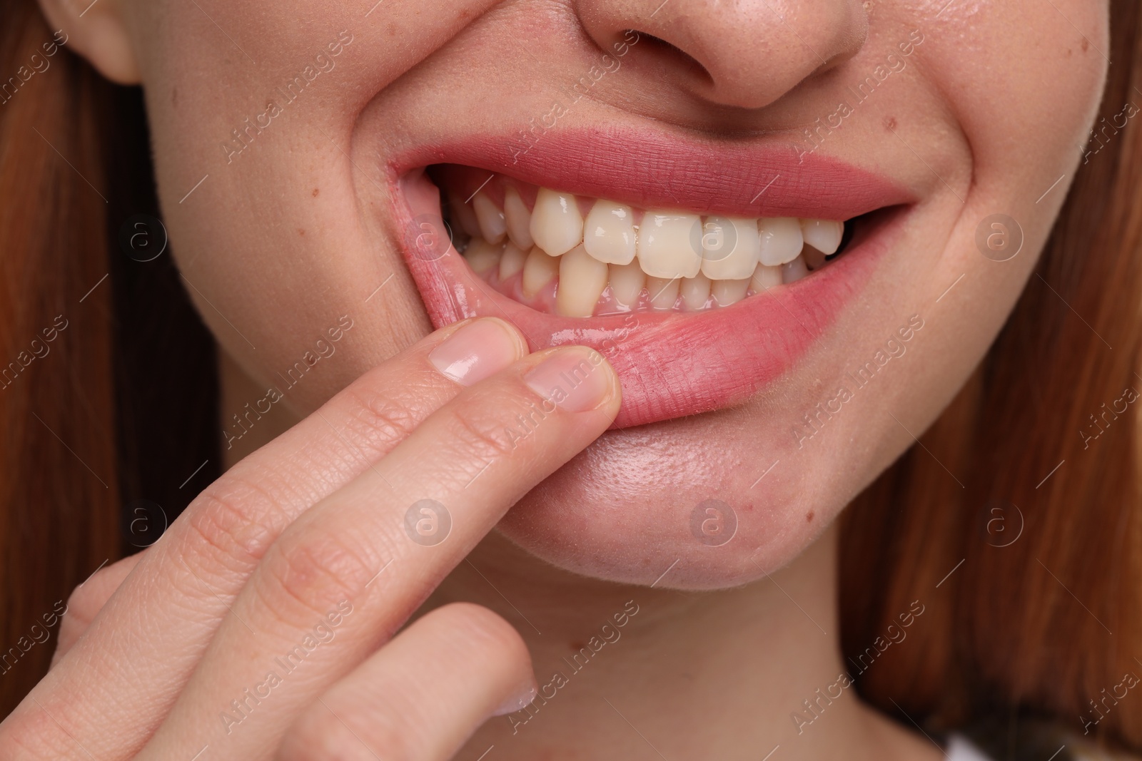 Photo of Woman showing her clean teeth, closeup view