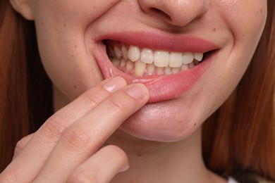 Woman showing her clean teeth, closeup view