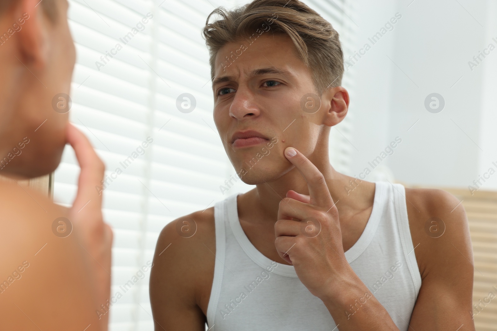 Photo of Upset young man looking at mirror and touching pimple on his face indoors. Acne problem