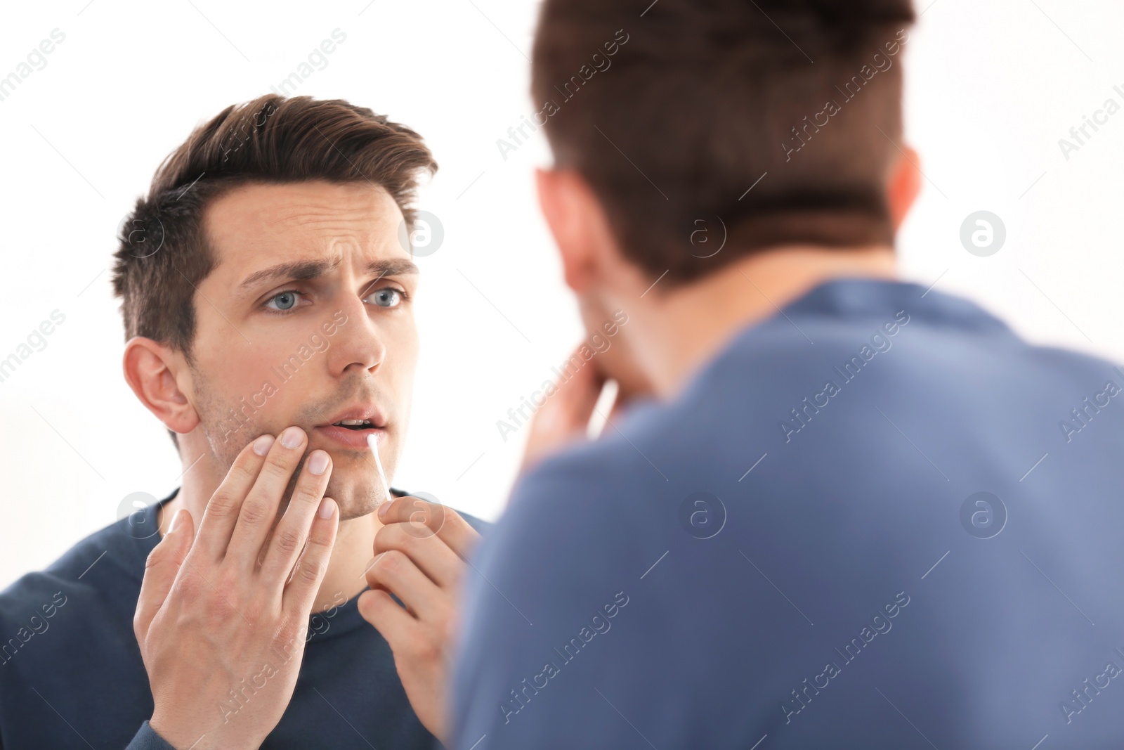 Photo of Young man applying cold sore cream on lips in front of mirror