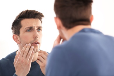 Young man applying cold sore cream on lips in front of mirror