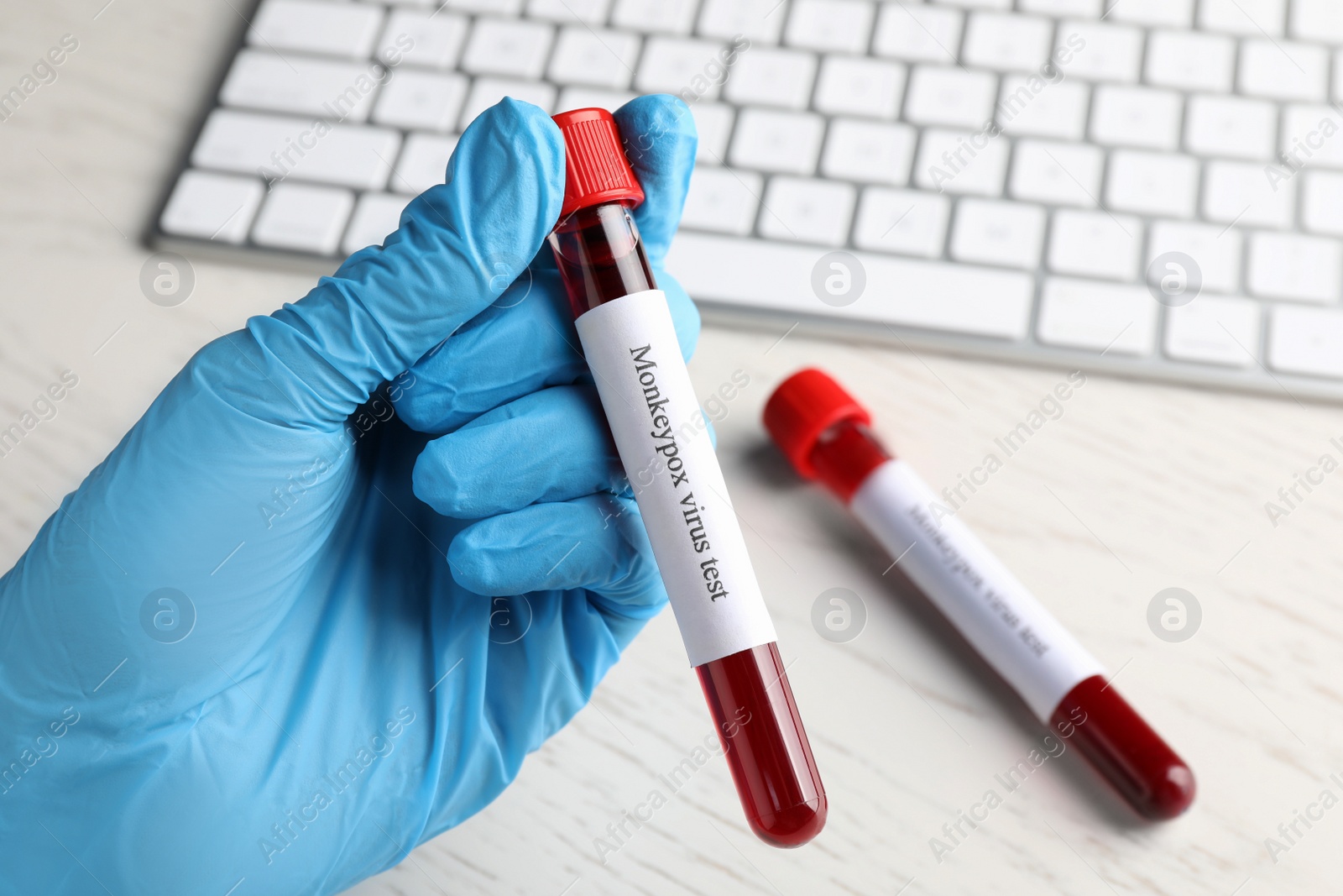 Photo of Monkeypox virus test. Laboratory worker holding sample tube with blood over table, closeup