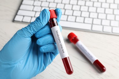 Monkeypox virus test. Laboratory worker holding sample tube with blood over table, closeup