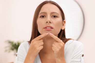 Woman with skin problem indoors, view from mirror