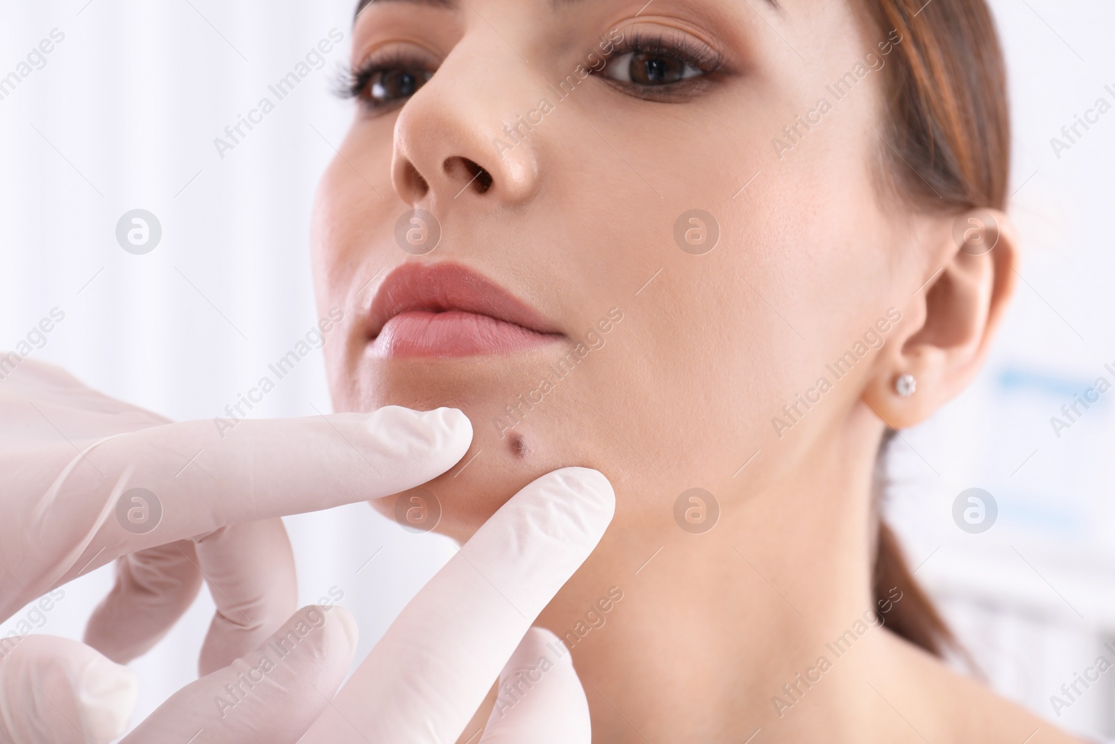 Photo of Dermatologist examining patient in clinic, closeup view