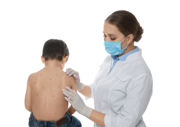 Photo of Doctor examining little boy with chickenpox on white background. Varicella zoster virus