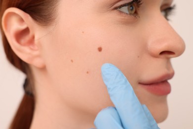Photo of Dermatologist examining patient's birthmark on beige background, closeup
